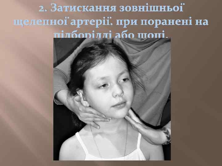 2. Затискання зовнішньої щелепної артерії. при поранені на підборідді або щоці. 