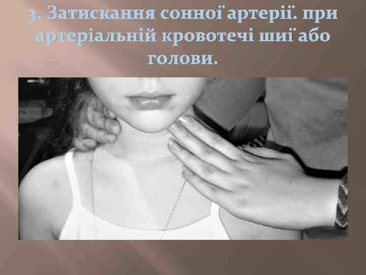 3. Затискання сонної артерії. при артеріальній кровотечі шиї або голови. 