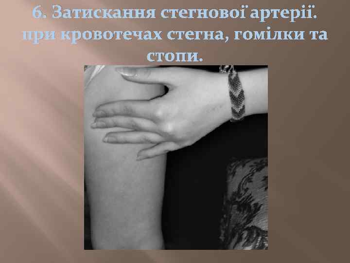 6. Затискання стегнової артерії. при кровотечах стегна, гомілки та стопи. 