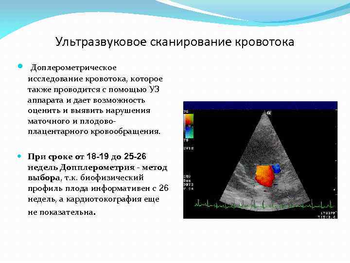 Ультразвуковое сканирование кровотока Доплерометрическое исследование кровотока, которое также проводится с помощью УЗ аппарата и