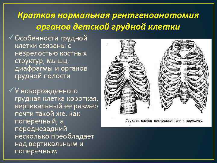 Краткая нормальная рентгеноанатомия органов детской грудной клетки ü Особенности грудной клетки связаны с незрелостью