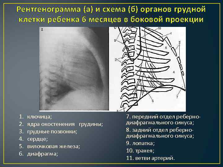 Рентгенограмма (а) и схема (б) органов грудной клетки ребенка 6 месяцев в боковой проекции
