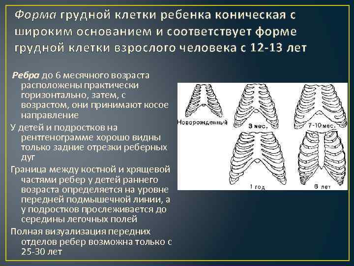 Формы грудной клетки