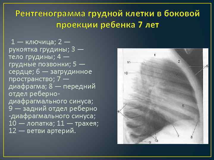 Схема описания рентгенограммы грудной клетки