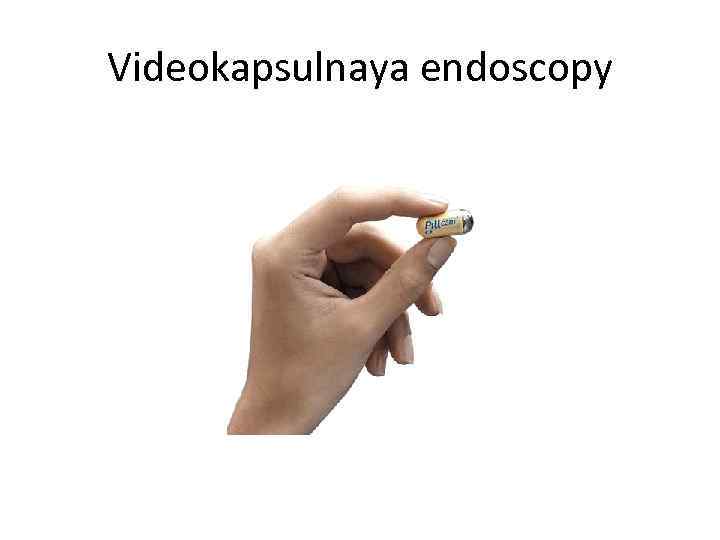 Videokapsulnaya endoscopy 