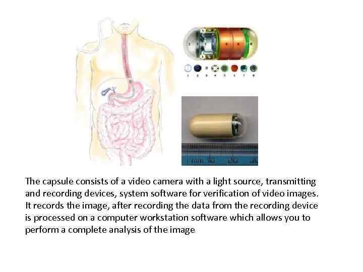 The capsule consists of a video camera with a light source, transmitting and recording