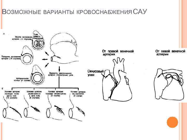ВОЗМОЖНЫЕ ВАРИАНТЫ КРОВОСНАБЖЕНИЯ САУ 