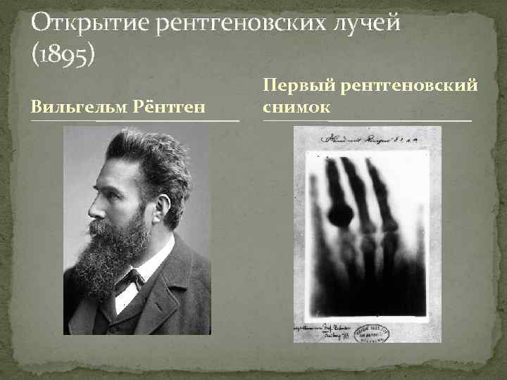 1 рентгеновский снимок. Вильгельм рентген рентгеновские лучи. 1895 Открытие рентгеновских лучей. Вильгельм рентген первый снимок. Рентген открытие рентгеновских лучей.