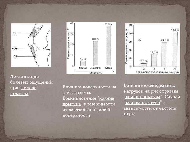 Локализация болевых ощущений при "колене прыгуна" Влияние поверхности на риск травмы. Возникновение "колена прыгуна"