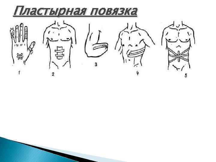 Пластырная повязка 