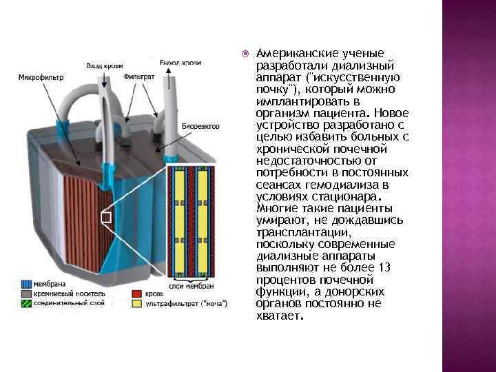  Американские ученые разработали диализный аппарат ("искусственную почку"), который можно имплантировать в организм пациента.