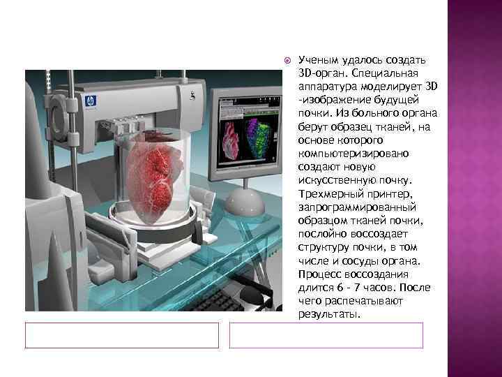  Ученым удалось создать 3 D-орган. Специальная аппаратура моделирует 3 D -изображение будущей почки.