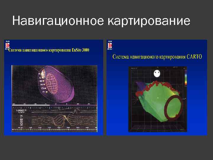 Навигационное картирование 