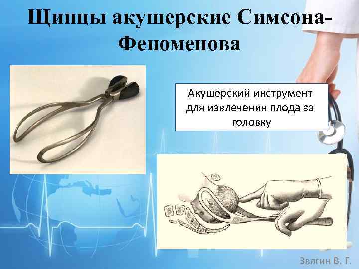 Щипцы акушерские Симсона. Феноменова Акушерский инструмент для извлечения плода за головку Звягин В. Г.