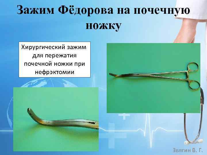 Зажим Фёдорова на почечную ножку Хирургический зажим для пережатия почечной ножки при нефрэктомии Звягин