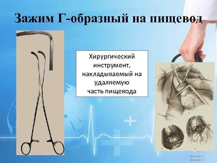 Зажим Г-образный на пищевод Хирургический инструмент, накладываемый на удаляемую часть пищевода Звягин В. Г.