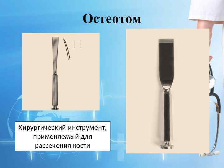 Остеотом Хирургический инструмент, применяемый для рассечения кости 