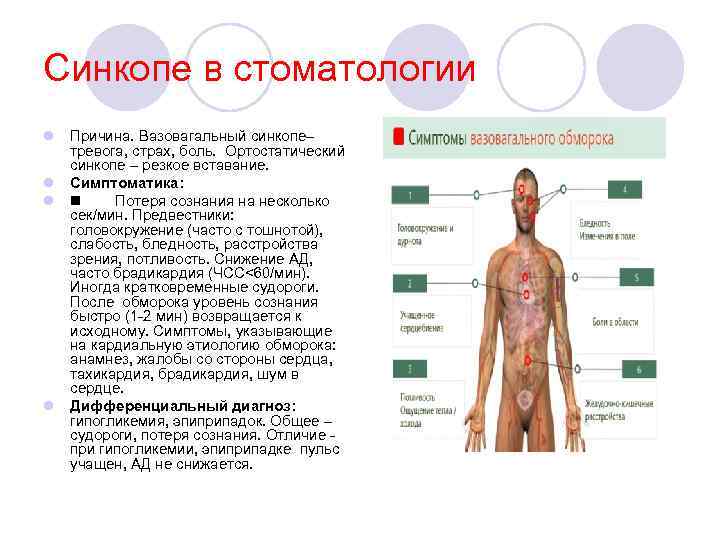 Синкопе в стоматологии l Причина. Вазовагальный синкопе– тревога, страх, боль. Ортостатический синкопе – резкое