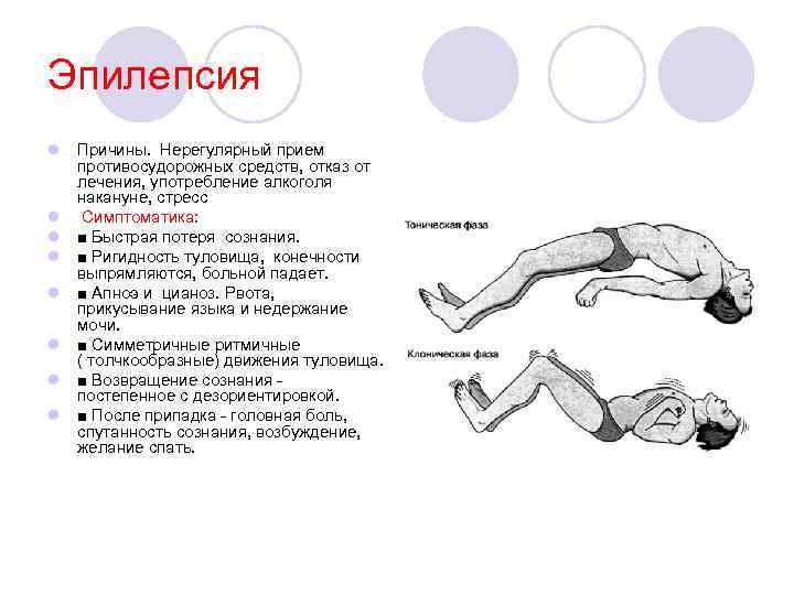 Эпилепсия l Причины. Нерегулярный прием противосудорожных средств, отказ от лечения, употребление алкоголя накануне, стресс
