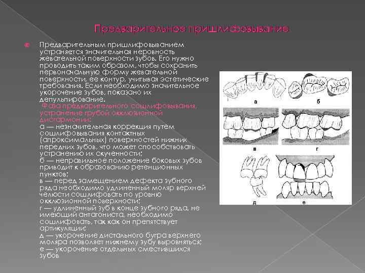 Предварительное пришлифовывание Предварительным пришлифовыванием устраняется значительная неровность жевательной поверхности зубов. Его нужно проводить таким