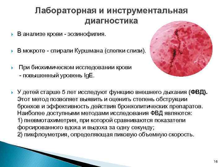 Лабораторная и инструментальная диагностика В анализе крови эозинофилия. В мокроте спирали Куршмана (слепки слизи).