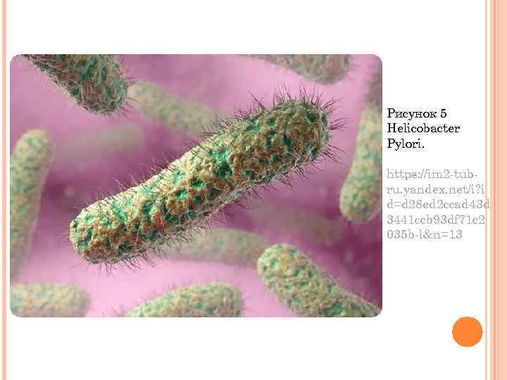 Рисунок 5 Helicobacter Pylori. https: //im 2 -tubru. yandex. net/i? i d=d 28 ed