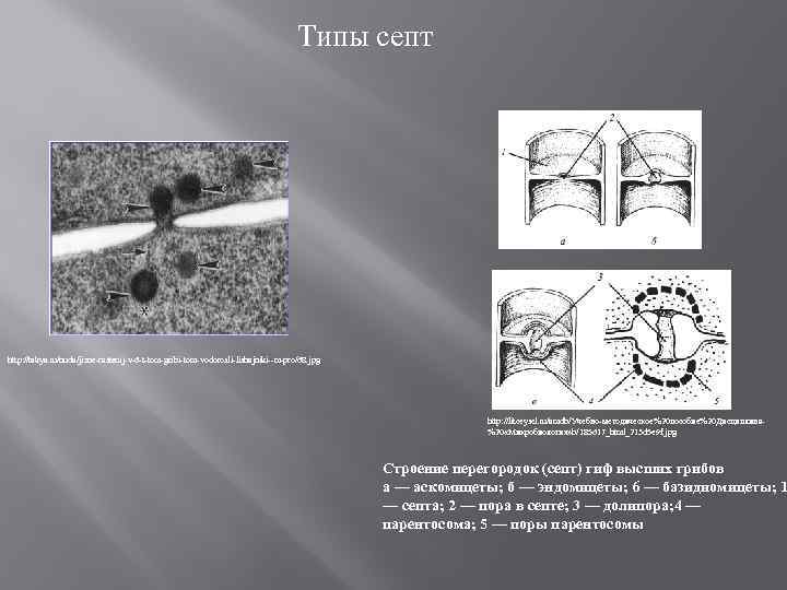 Типы септ http: //takya. ru/nuda/jizne-rastenij-v-6 -t-tom-gribi-tom-vodorosli-lishajniki--m-pro/68. jpg http: //litceysel. ru/amdb/Учебно-методическое%20 пособие%20 Дисциплина%20 «Микробиология» b/185617_html_213