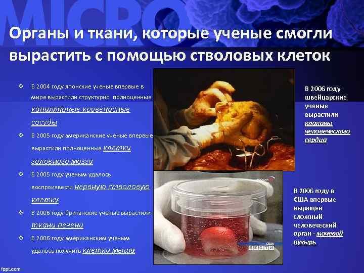Органы и ткани, которые ученые смогли вырастить с помощью стволовых клеток v В 2004