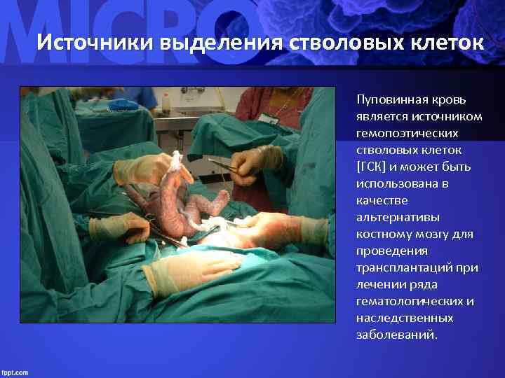 Источники выделения стволовых клеток Пуповинная кровь является источником гемопоэтических стволовых клеток [ГСК] и может