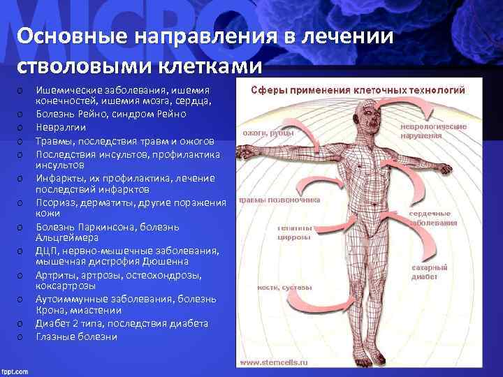 Основные направления в лечении стволовыми клетками o o o o Ишемические заболевания, ишемия конечностей,