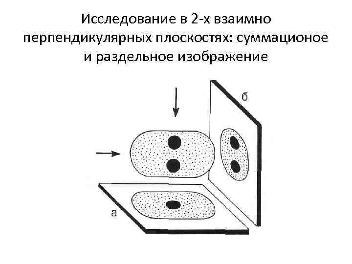 Исследование в 2 -х взаимно перпендикулярных плоскостях: суммационое и раздельное изображение 