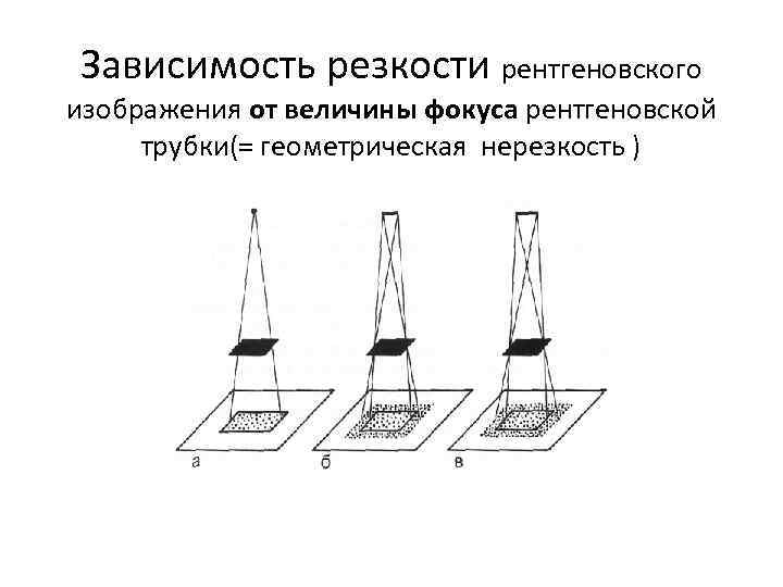 Зависимость резкости рентгеновского изображения от величины фокуса рентгеновской трубки(= геометрическая нерезкость ) 