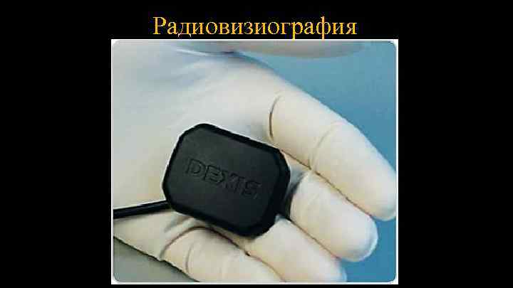 Радиовизиография 