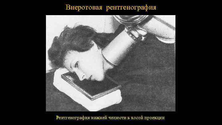 Внеротовая рентгенография Рентгенография нижней челюсти в косой проекции 