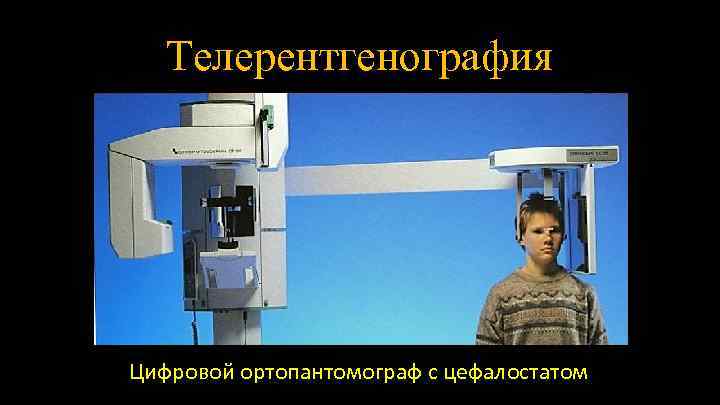 Телерентгенография Цифровой ортопантомограф с цефалостатом 