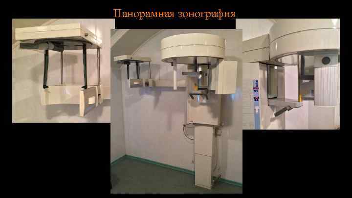 Панорамная зонография 