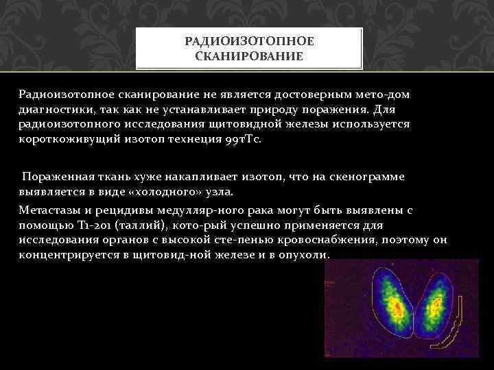 РАДИОИЗОТОПНОЕ СКАНИРОВАНИЕ Радиоизотопное сканирование не является достоверным мето дом диагностики, так как не устанавливает