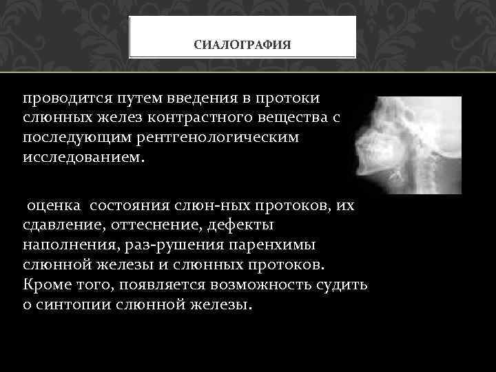  СИАЛОГРАФИЯ проводится путем введения в протоки слюнных желез контрастного вещества с последующим рентгенологическим