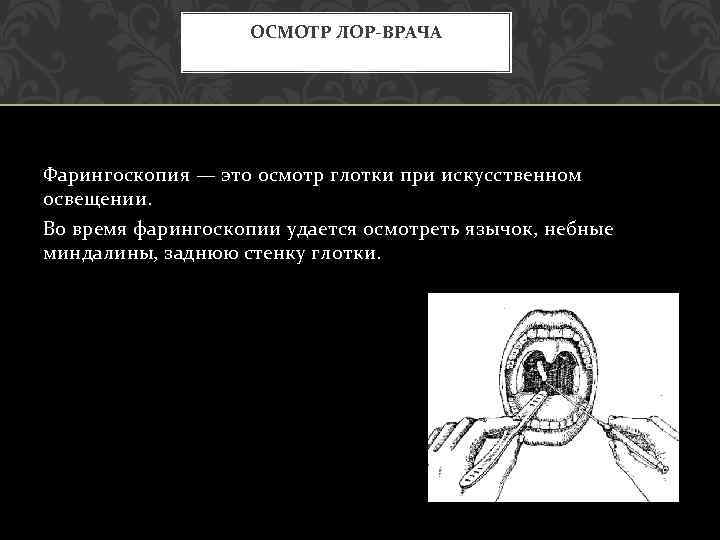 ОСМОТР ЛОР-ВРАЧА Фарингоскопия — это осмотр глотки при искусственном освещении. Во время фарингоскопии удается