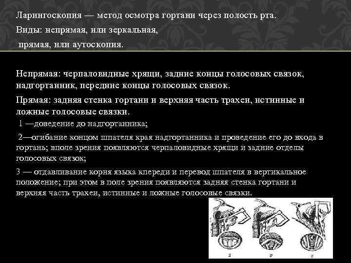 Ларингоскопия — метод осмотра гортани через полость рта. Виды: непрямая, или зеркальная, прямая, или