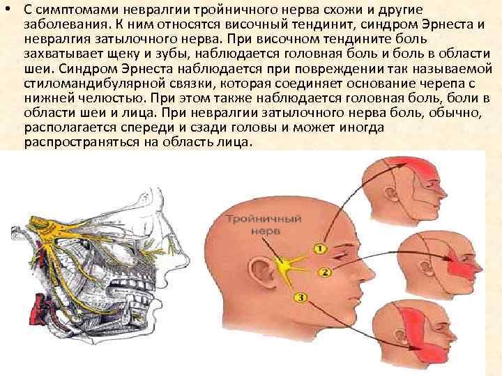Тройничный нерв справа. Болевые симптомы тройничный нерв. Клинические симптомы невралгии 2 ветви тройничного нерва. Тройничный нерв воспаление после травмы. Симптомы поражения тройничного нерва неврология.