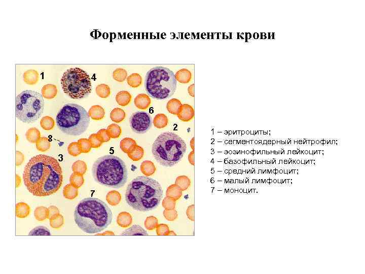 Форменные элементы крови 1 – эритроциты; 2 – сегментоядерный нейтрофил; 3 – эозинофильный лейкоцит;