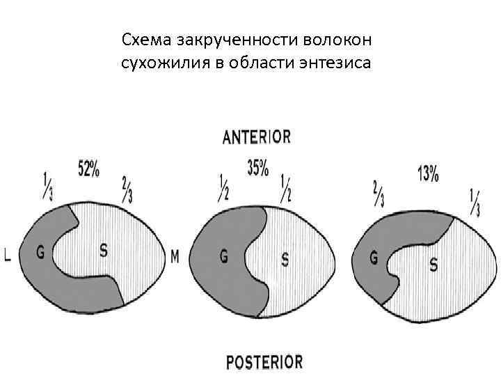 Схема закрученности волокон сухожилия в области энтезиса 