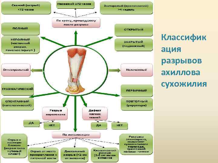 Классифик ация разрывов ахиллова сухожилия 