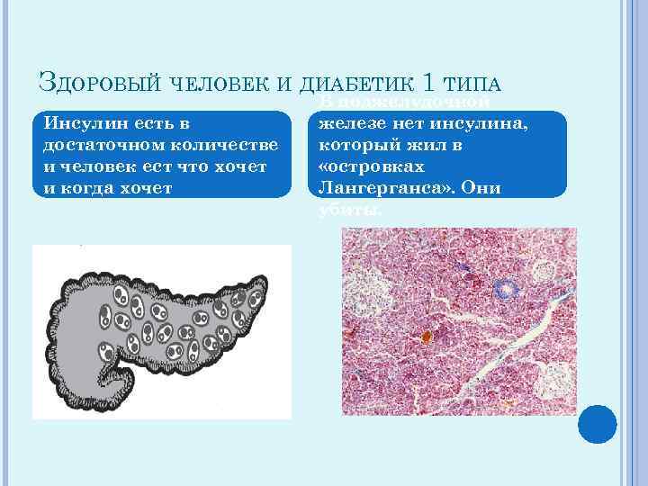 ЗДОРОВЫЙ ЧЕЛОВЕК И ДИАБЕТИК 1 ТИПА Инсулин есть в достаточном количестве и человек ест