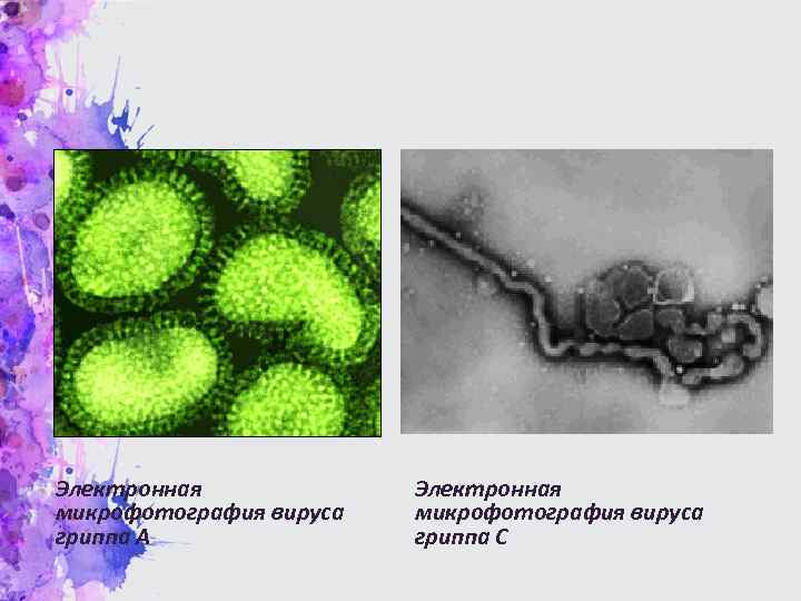Электронная микрофотография вируса гриппа А Электронная микрофотография вируса гриппа С 
