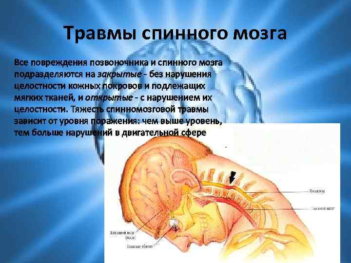 Травмы спинного мозга Все повреждения позвоночника и спинного мозга подразделяются на закрытые - без