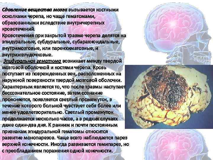 Сдавление вещества мозга вызывается костными осколками черепа, но чаще гематомами, образованными вследствие внутричерепных кровотечений.