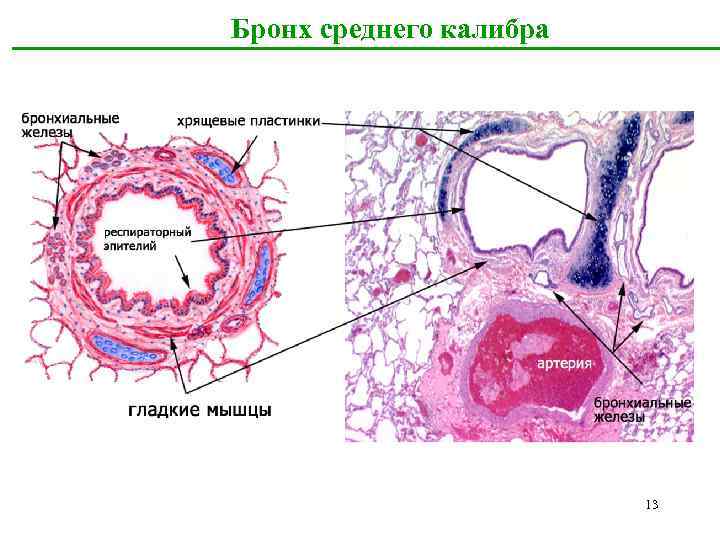 Бронх среднего калибра 13 