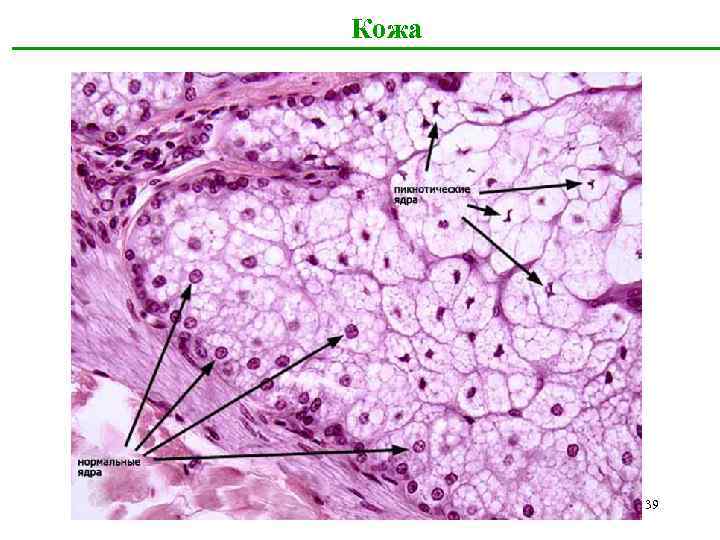 Кожа 39 